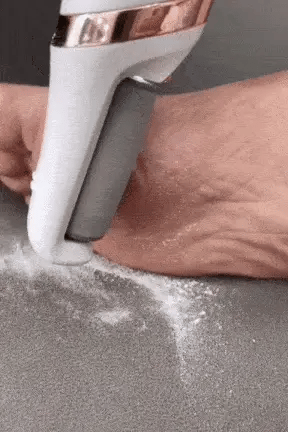Electric Pedicure Foot File Callus Remover - ekhonibuy